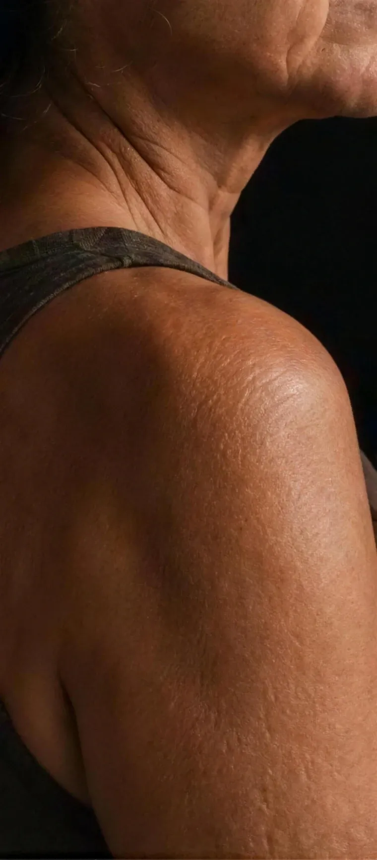 A shoulder and upper arm in warm directional light, skin shown as ordinary and healthy